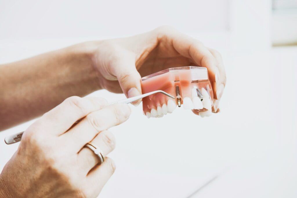Implantes dentales en Chamberí