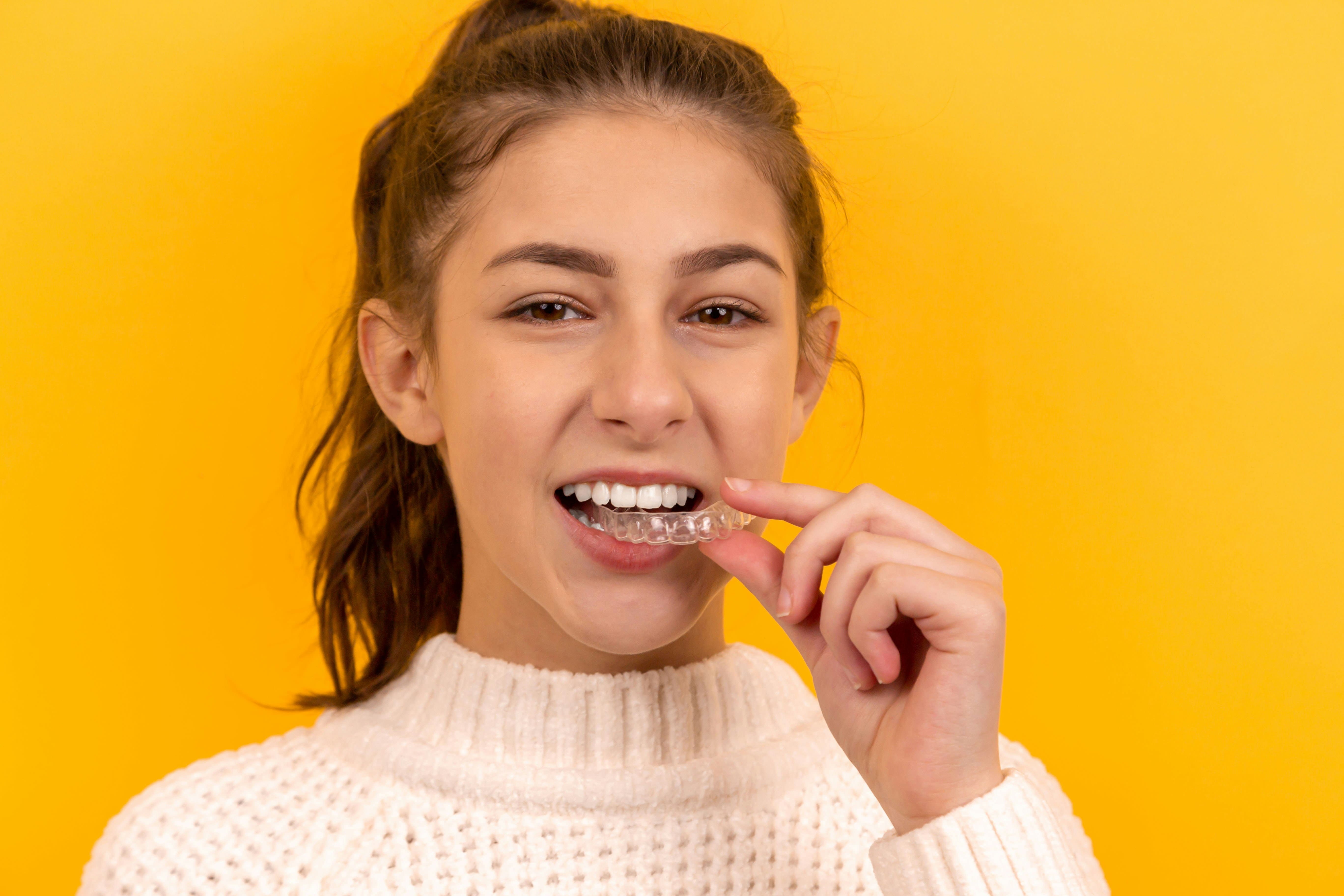 Blanqueamiento dental en Madrid