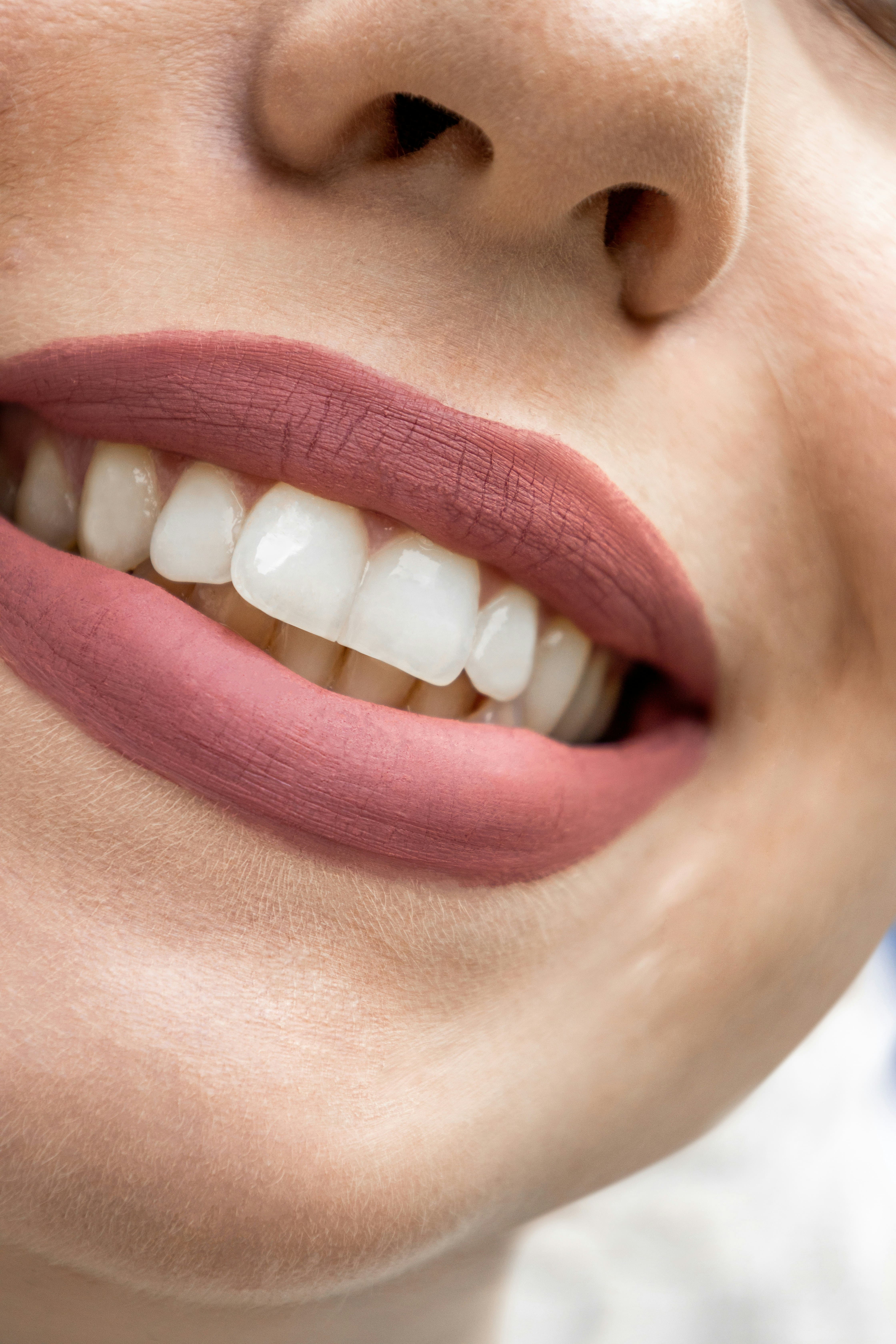 endodoncia en madrid